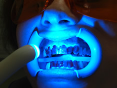 UV-Lampe im eingeschalteten Zustand